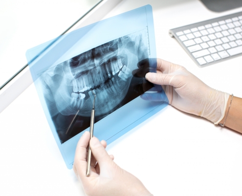 dentist-examines-x-ray-photo-teeths
