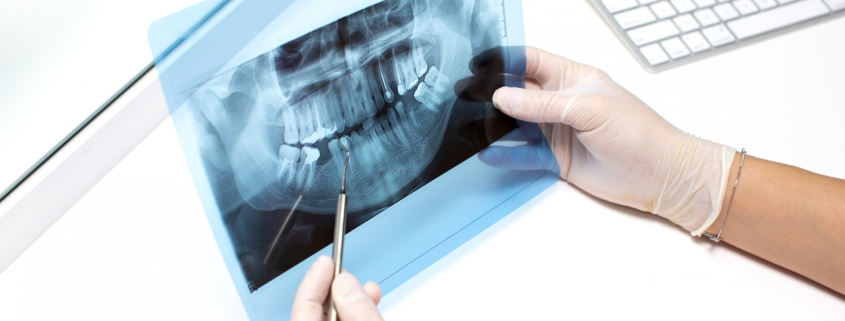 dentist-examines-x-ray-photo-teeths